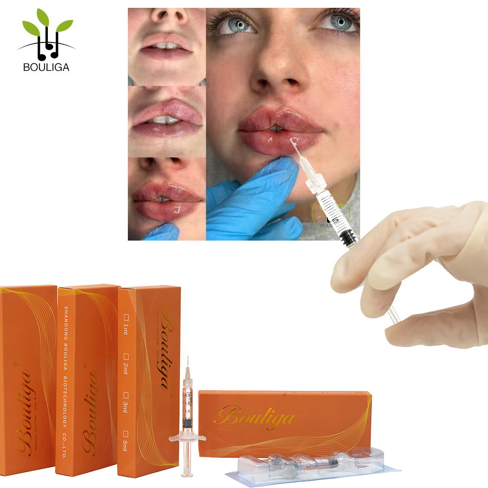 Bouliga Cross Linked Hyaluronic Acid Filler 1ml 2ml 5ml Remplisseur cutané pour de belles lèvres 