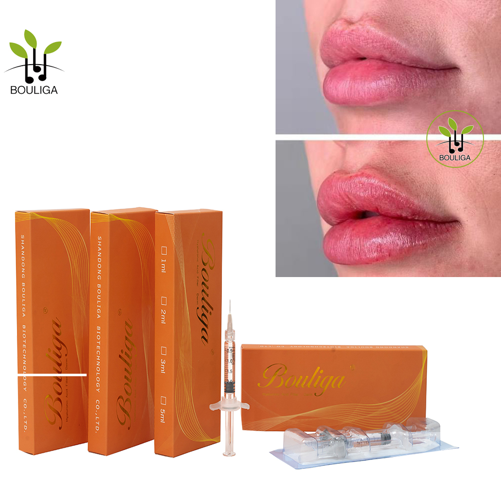 Magnifique Lip Filler de Bouliga 1ml 2ml 5ml 10ml