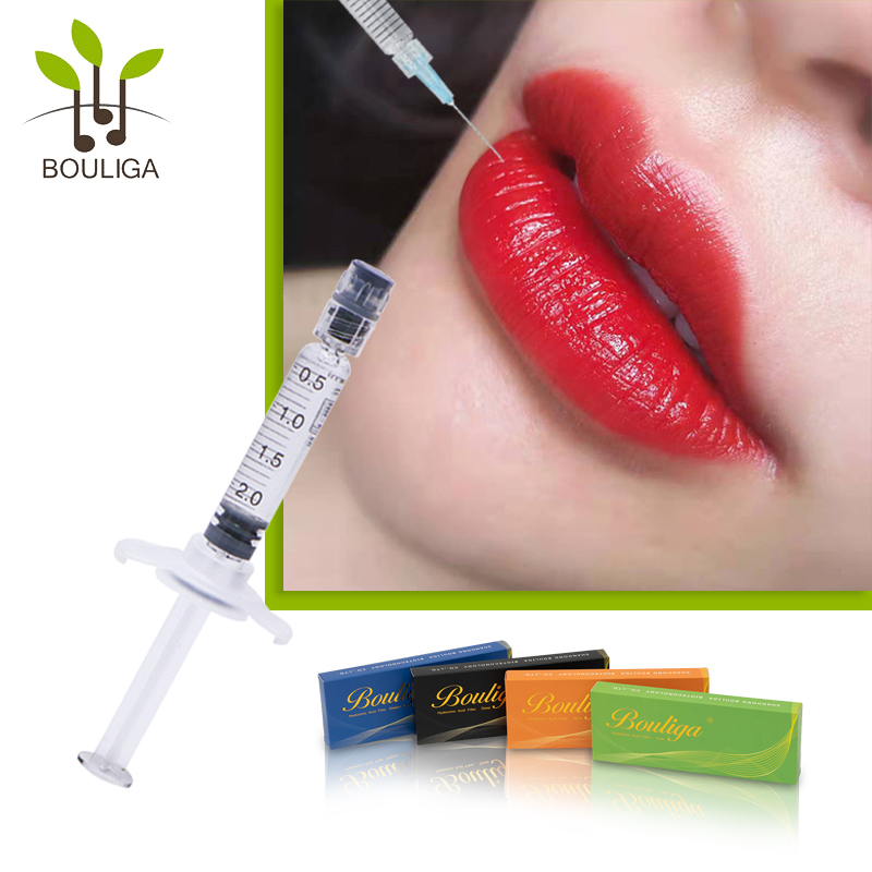 Bouliga Dermal Filler pour de belles lèvres 1 ml 2 ml 5 ml