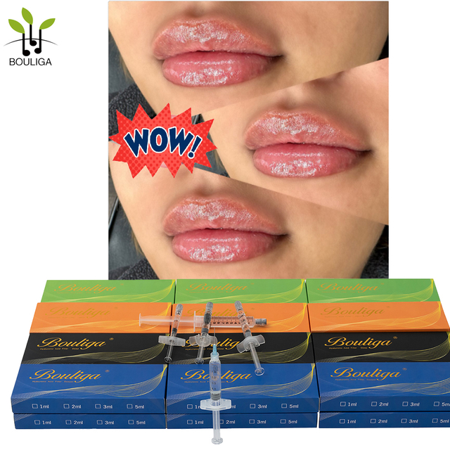 Bouliga Dermal filler 2ml 100% acide hyaluronique concentration 20mg/ml pour Lip Glow Up
